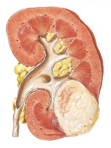 kidney03